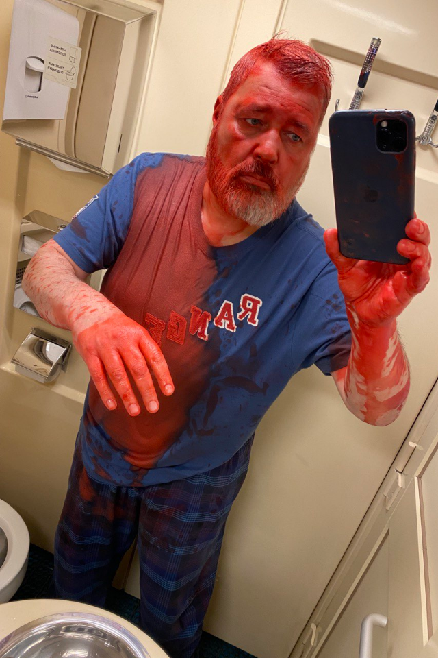 Подозреваемые в нападении на Дмитрия Муратова могут быть связаны с «делом Голунова»