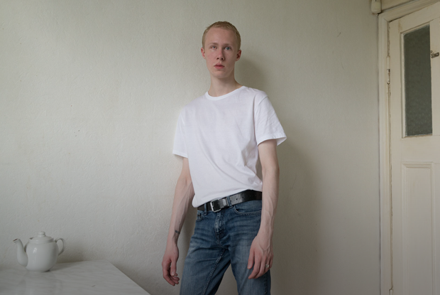 «Я потерял глаз и даже рад, что это случилось»